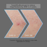 Garnier Pure Active Aha Bha Charcoal Serum, 30ml