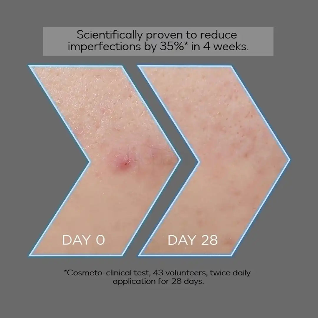 Garnier Pure Active Aha Bha Charcoal Serum, 30ml